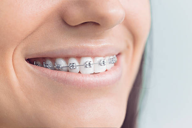 Full Mouth Reconstruction in Ephraim, UT